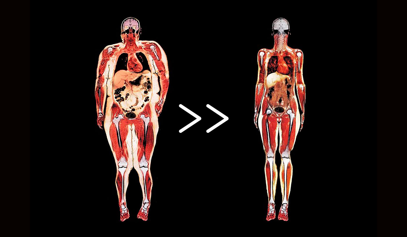 Как перекачать жир в мышцы?