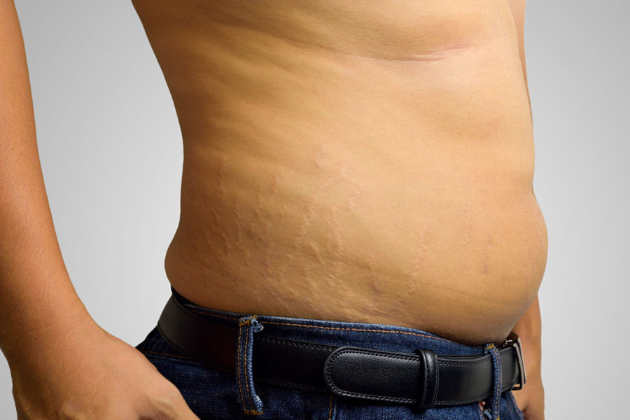 Как убрать жир с живота — 100% научный метод похудения